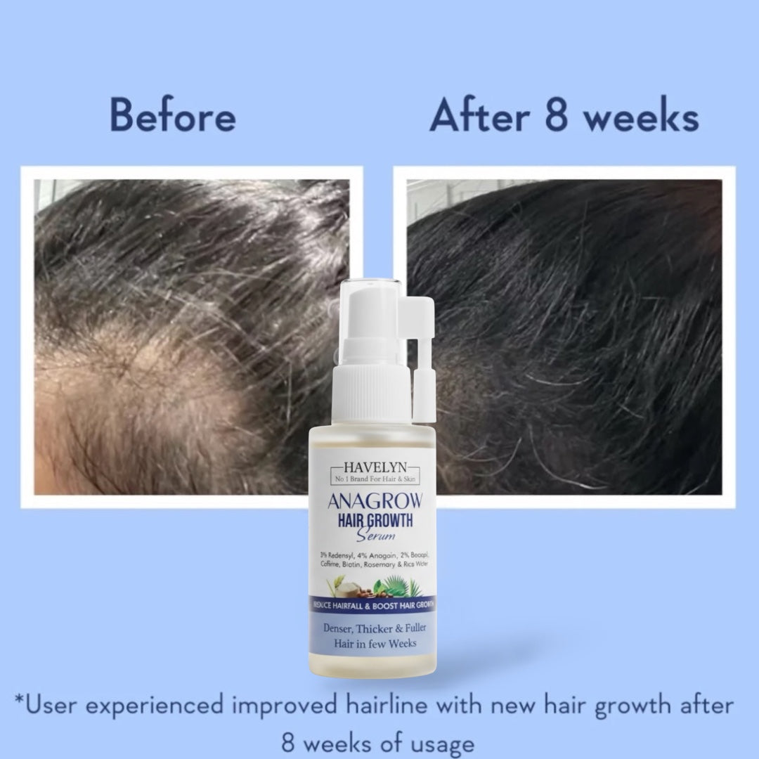 ANAGROW Hair Growth