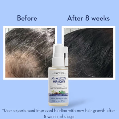 ANAGROW Hair Growth
