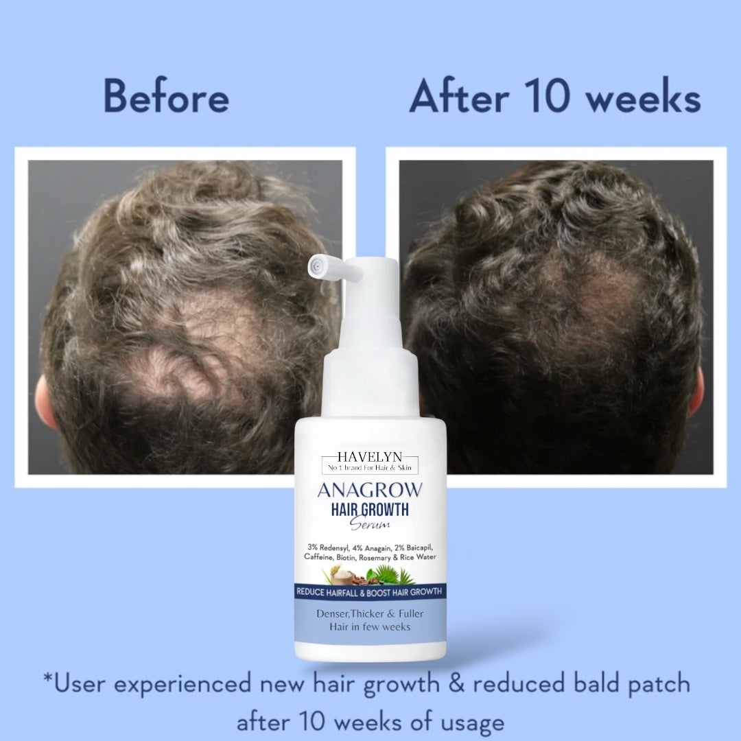 ANAGROW Hair Growth