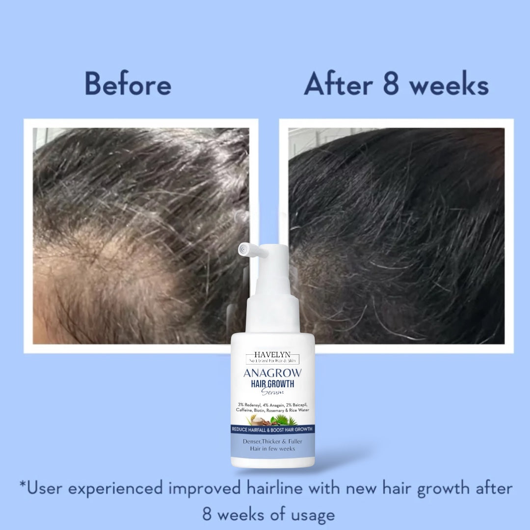 ANAGROW Hair Growth