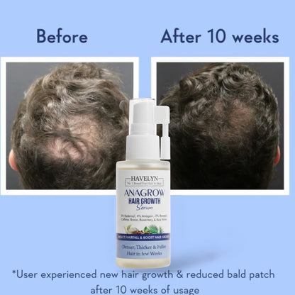 ANAGROW Hair Growth
